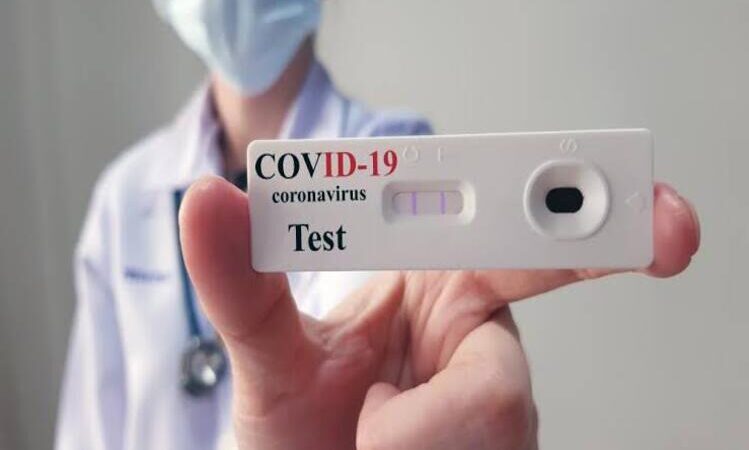 São Fidélis não está recebendo testes rápidos de Covid-19 do Estado